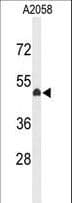 EYA4 Antibody (aa1-30)