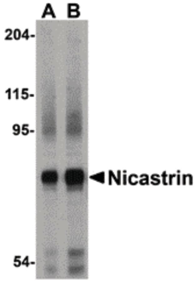 IHC-plus™ NCSTN / Nicastrin Antibody
