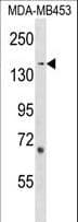 Polyclonal Rabbit anti-Human ARHGEF11 Antibody (aa605-632, WB)