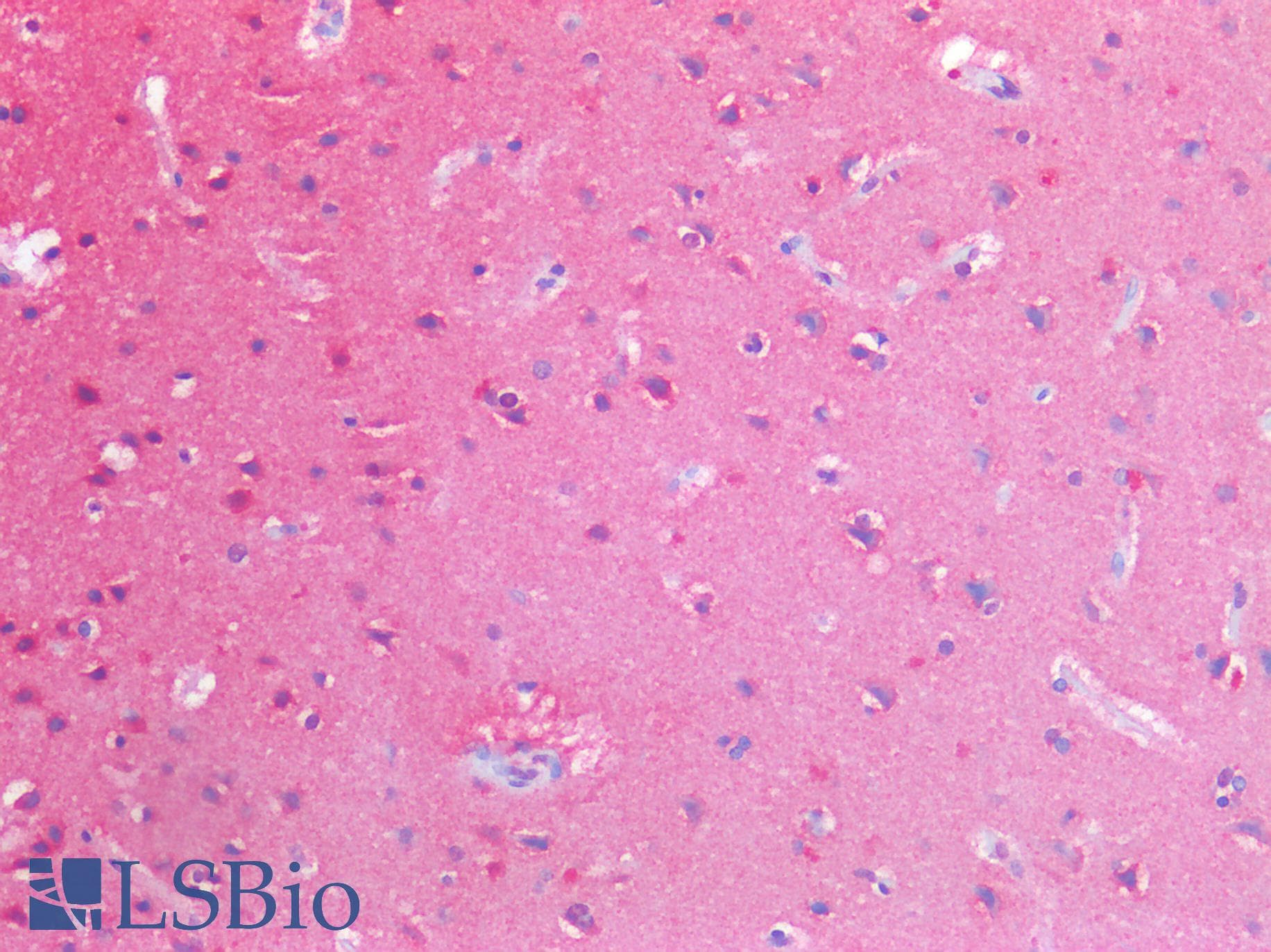 IHC-plus™ HPRT1 / HPRT Antibody (clone AT1D9)