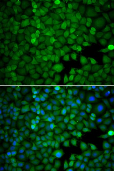HDAC7 Antibody
