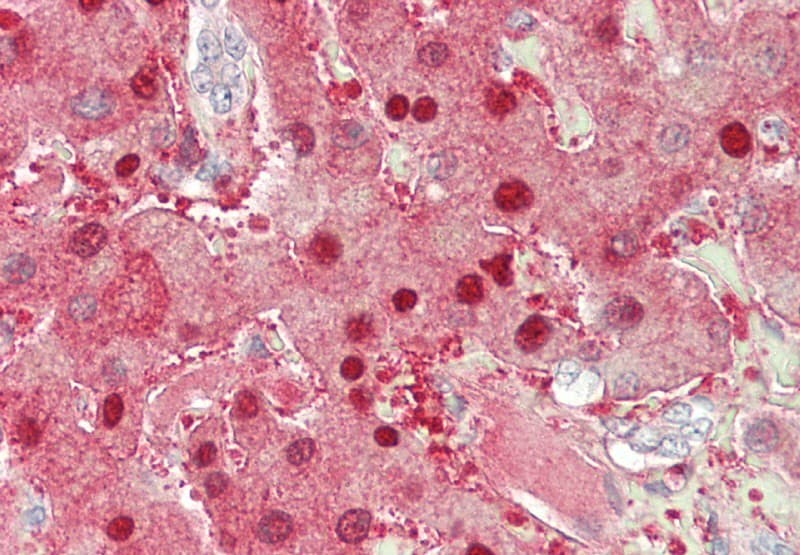 PathPlus™ ARG1 / Arginase 1 Antibody (aa11-97, clone ABM4B35)