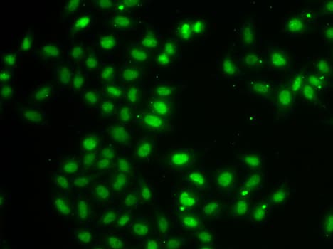 Polyclonal Rabbit anti-Human DUSP22 / JSP 1 Antibody (IHC, IF, WB)