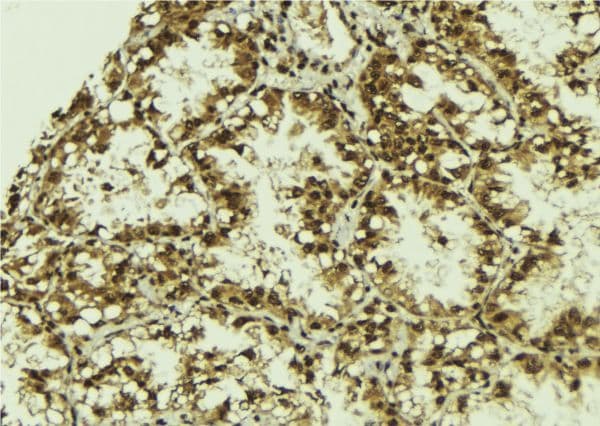 SRPK2 Antibody