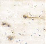 MARK1 / MARK Antibody (aa6-40)