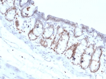 FOXA1 Antibody (clone FOXA1/1518)