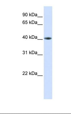 PathPlus™ Polyclonal Rabbit anti-Human TDP-43 / TARDBP Antibody (aa252-301, IHC, WB)