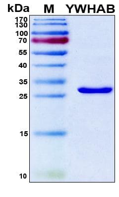 Human YWHAB / 14-3-3 Beta Protein (Recombinant 6His, N-terminus)