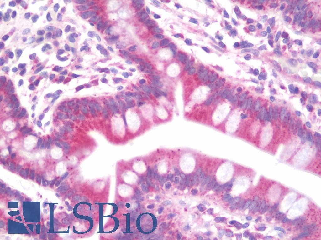 IHC-plus™ LPAR1 / LPA1 / EDG2 Antibody (Trp45)