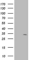 Monoclonal Mouse anti-Human SDR9C7 Antibody (clone OTI10F11, Carrier-free, aa1-313, WB)