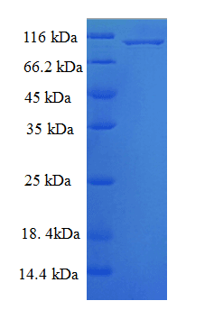 Human MAPK6 / ERK3 Protein (Recombinant His-SUMO)