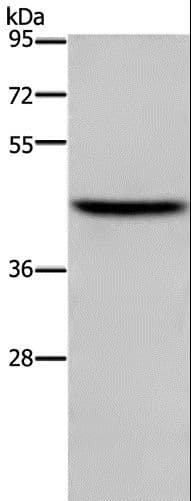 Polyclonal Rabbit anti-Human TFDP1 Antibody (WB)