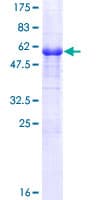 Human NACA2 Protein (Recombinant GST)