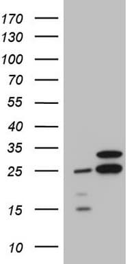 RPL10 / Ribosomal Protein L10 Antibody (clone OTI6B11)