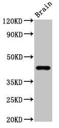 GPR143 Antibody