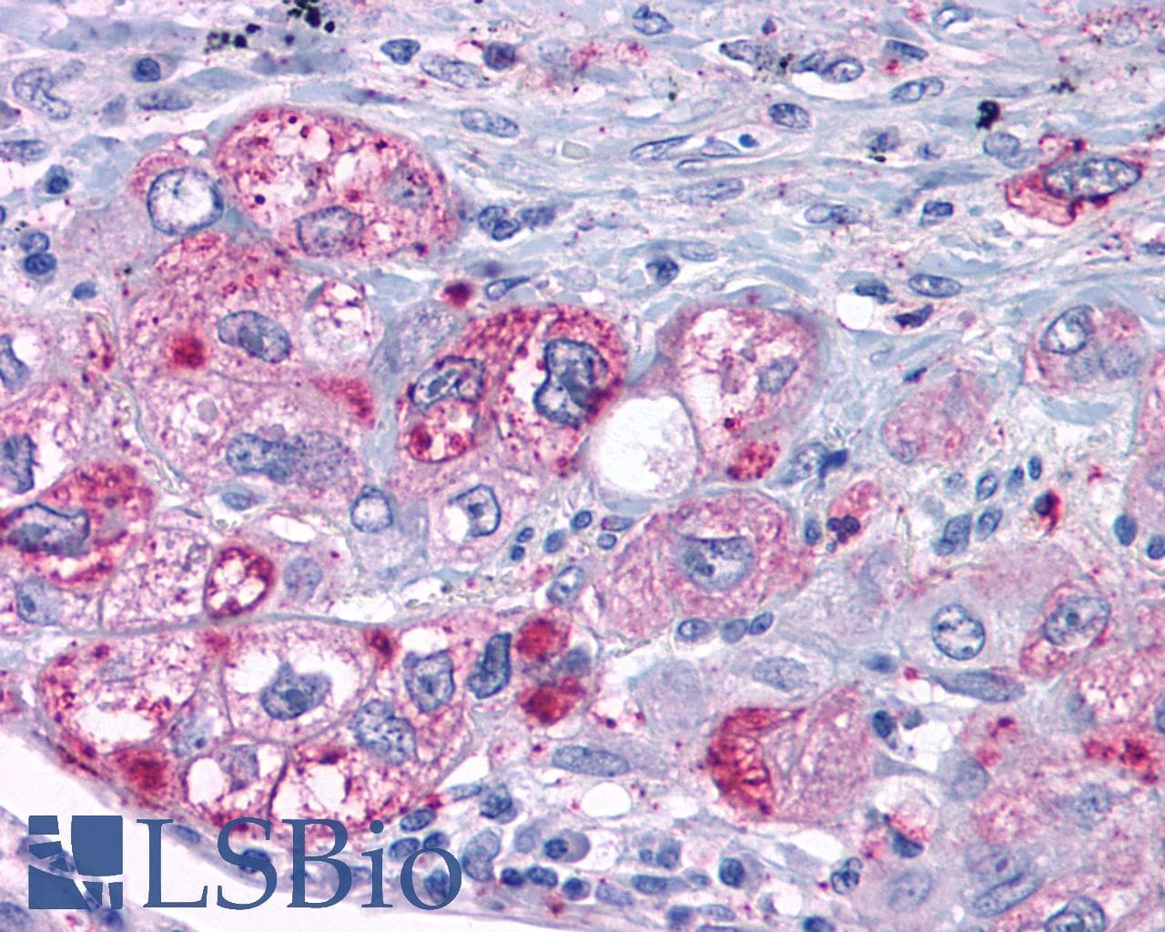 PathPlus™ Polyclonal Rabbit anti-Human MAS1 / MAS Antibody (C-Terminus, IHC)