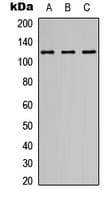 GRIN1 / NMDAR1 Antibody (C-Terminus)