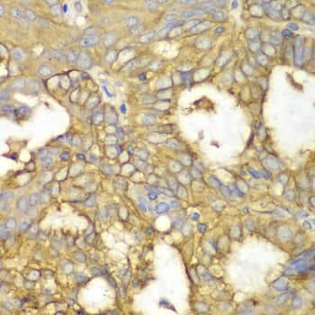 IHC-plus™ Polyclonal Rabbit anti-Human PRKAR1A Antibody (IHC, IF, WB)