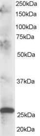 IHC-plus™ CLPP Antibody (aa265-277)