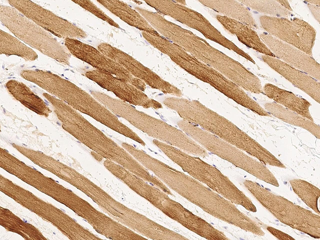CKM / Creatine Kinase MM Antibody (Preservative Free)