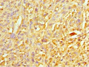 Polyclonal Rabbit anti-Human XIAP Antibody (aa1-200, IHC, WB)