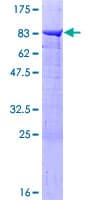 Human PPP2R5A Protein (Recombinant GST)