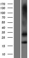 TMEM88 Protein (Over-Expression Lysate Myc-DDK (Flag))