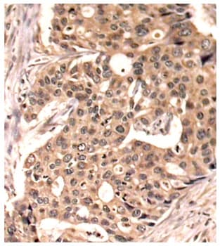 PXN / Paxillin Antibody (phospho-Tyr118)