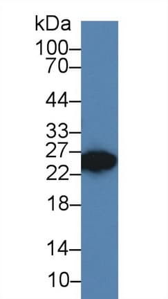 DKKL1 / Soggy-1 Antibody (aa21-230)
