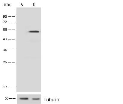 PRKAR1A Antibody (Preservative Free)