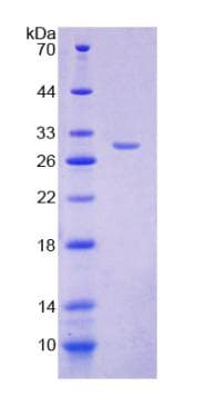 Human FOXP3 Protein (Recombinant His-T7)
