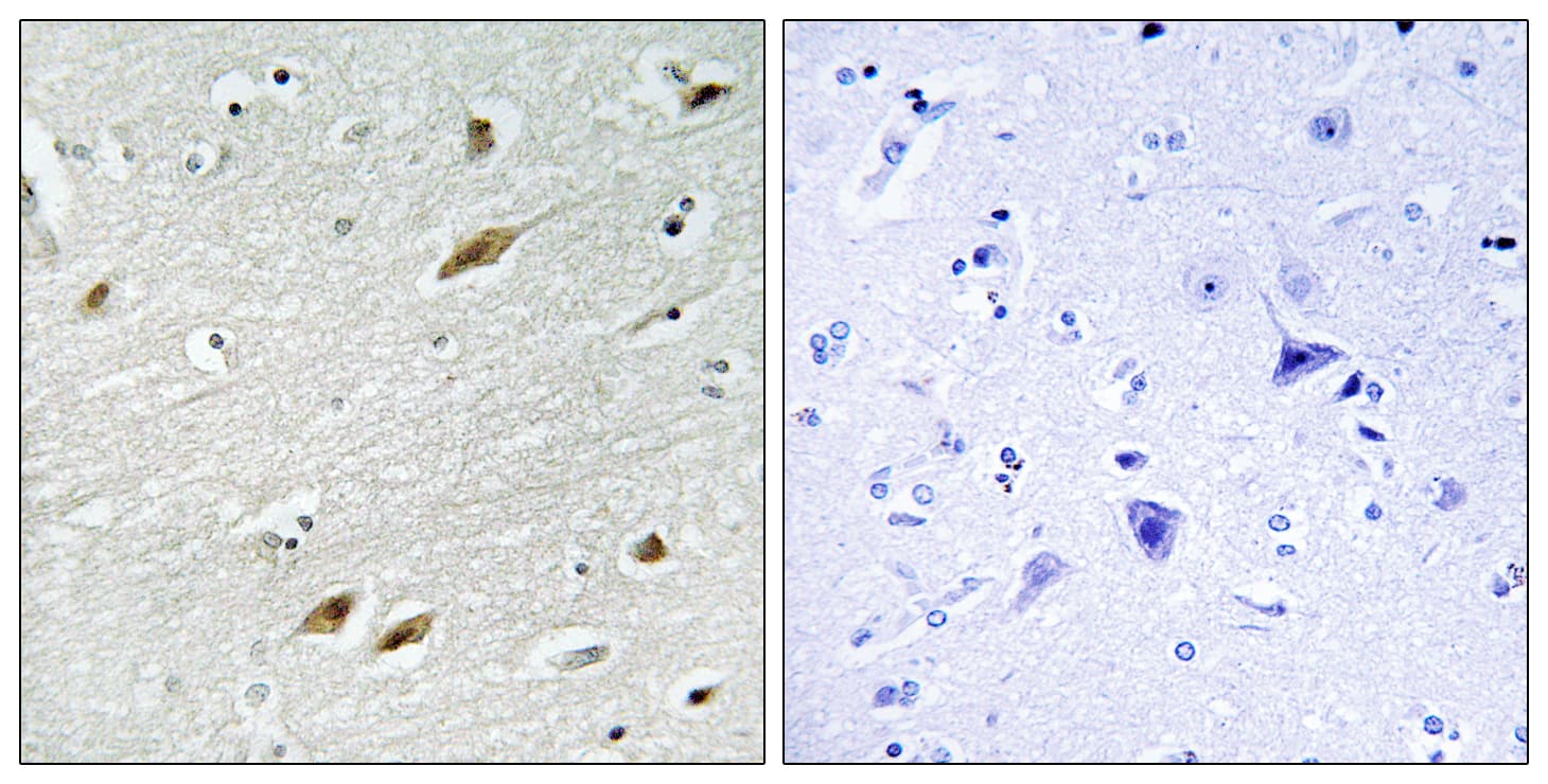 FOXO1 / FKHR Antibody (aa286-335)