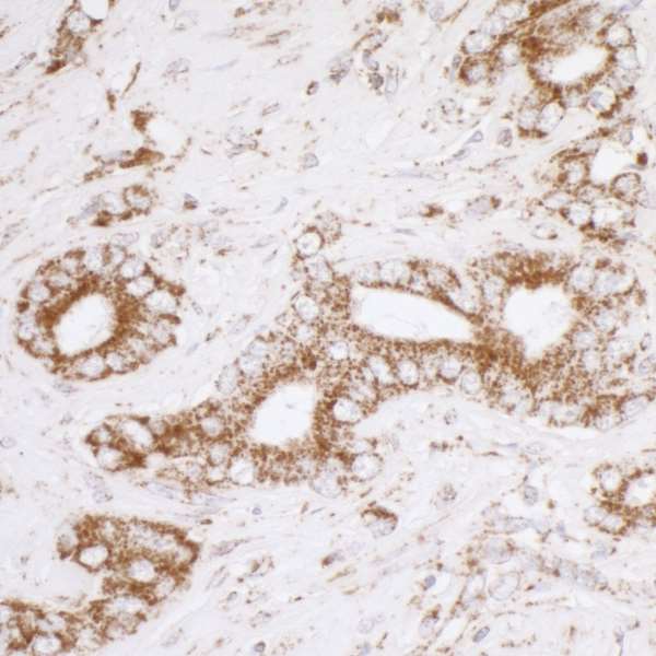 ATP5A1 / ATP Synthase Alpha Antibody (aa100-150)
