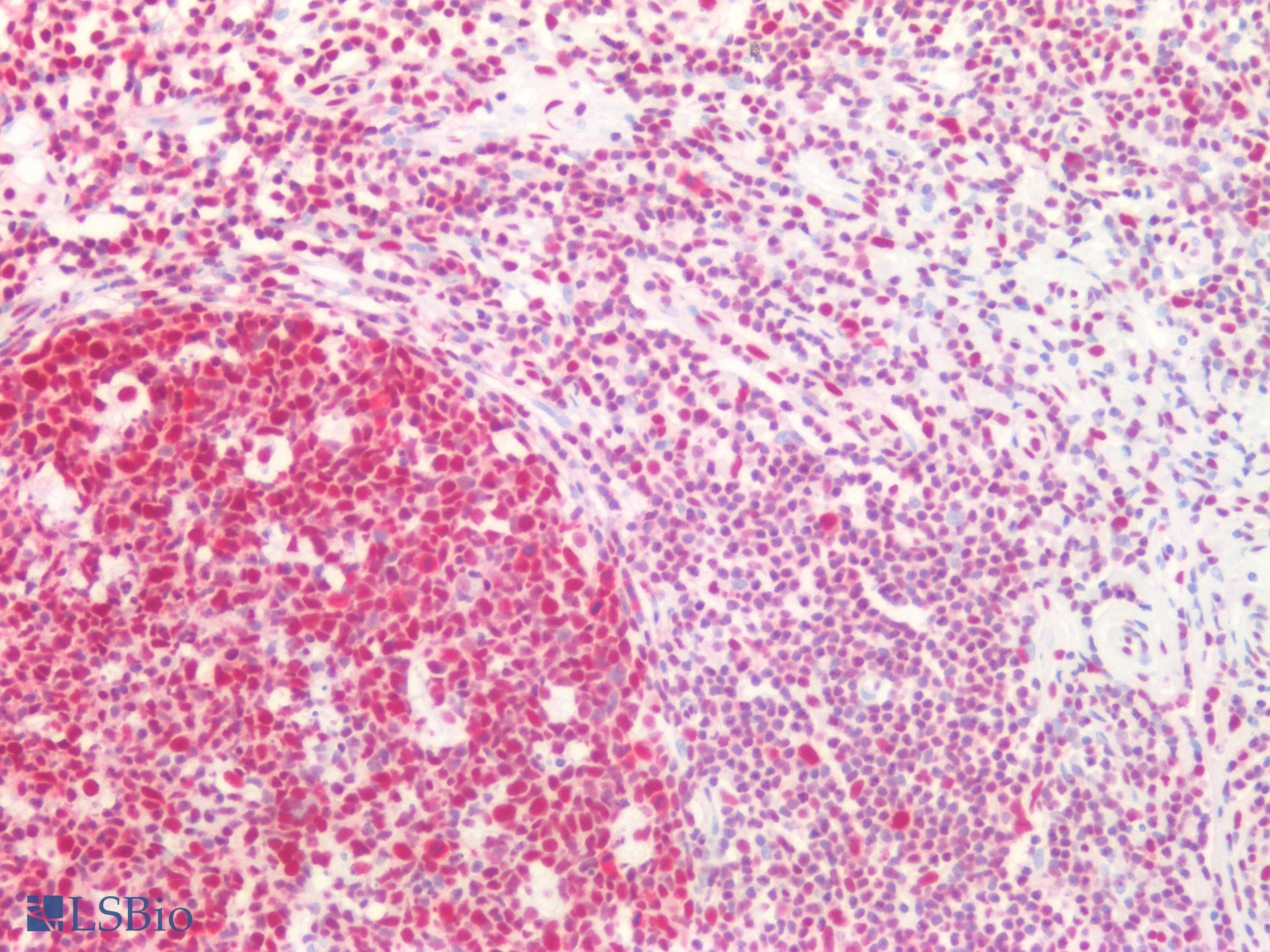 PathPlus™ Monoclonal Mouse anti-Human CBX3 / HP1 Gamma Antibody (IHC, WB)