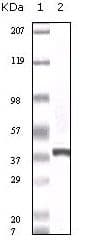 Monoclonal Mouse anti-Human S100A6 / Calcyclin Antibody (clone 7D11, IHC, WB)