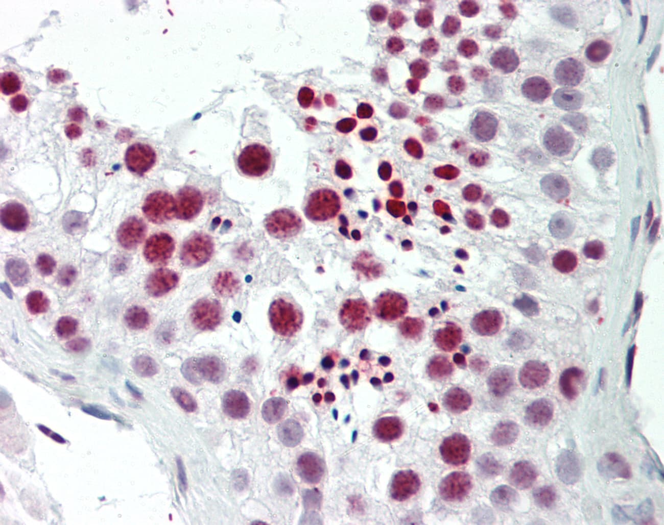 TNP1 / TP1 Antibody (C-Terminus)