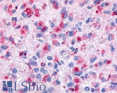 PathPlus™ Polyclonal Rabbit anti-Human ADGRE3 / EMR3 Antibody (N-Terminus, IHC)