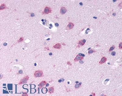 PathPlus™ GPRC6A Antibody (N-Terminus)