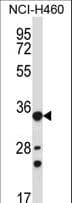 AKR1B10 Antibody (aa101-130)