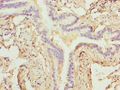 ZNF212 Antibody (aa1-495)
