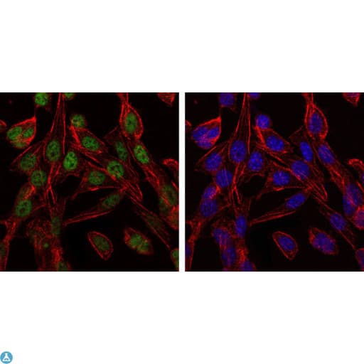 CCT2 / CCT Beta Antibody