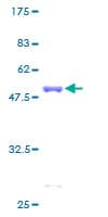 Human PRDX1 / Peroxiredoxin 1 Protein (Recombinant GST)