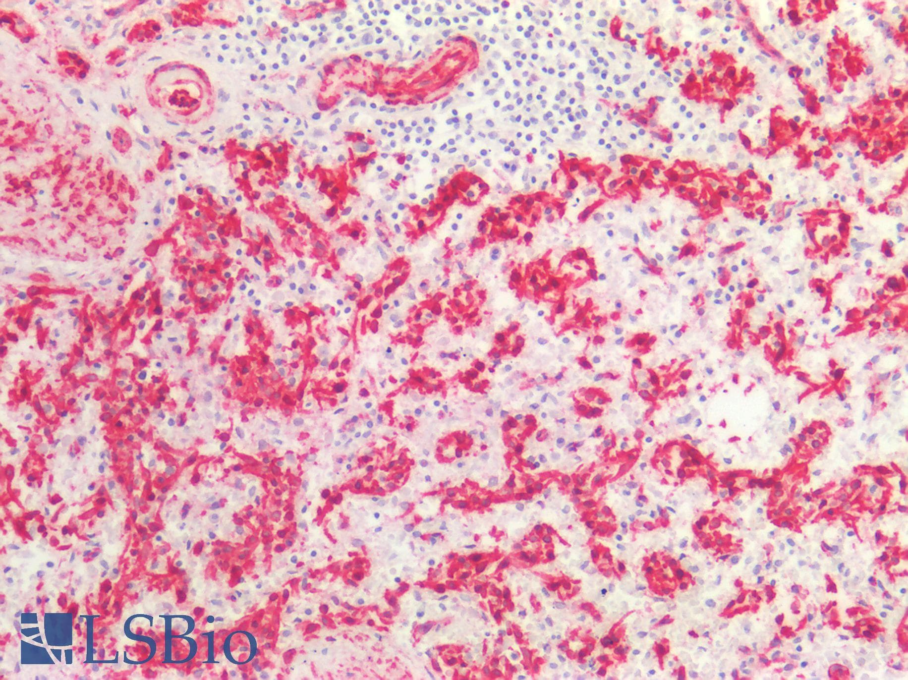 PathPlus™ CAV1 / Caveolin 1 Antibody (aa1-104)