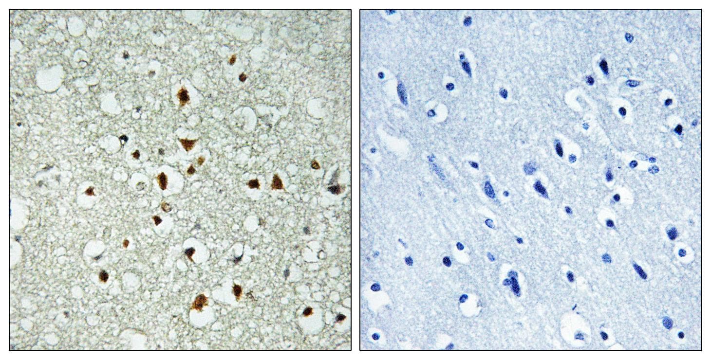 MAX Antibody