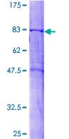 Human SNX4 Protein (Recombinant GST)