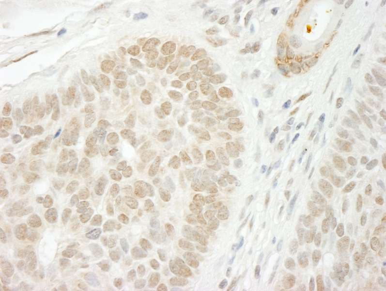 Polyclonal Rabbit anti-Human CSTF2T Antibody (aa566-616, IHC)