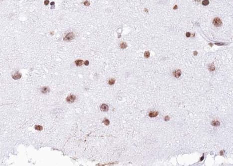 Histone H4 Antibody (Acetyl-Lys12)