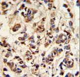 ATP6V1A1 / ATP6V1A Antibody (aa441-468)