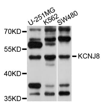 KCNJ8 / Kir6.1 Antibody