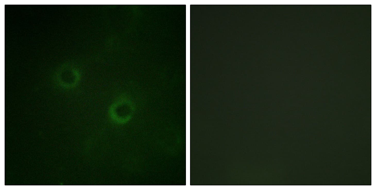p56lck / LCK Antibody (aa161-210)